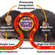 Image for article titled Could a cybernetic implant really help you lose weight?